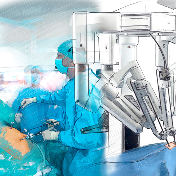 laparoscopic-vs-robot-assisted-general-surgery