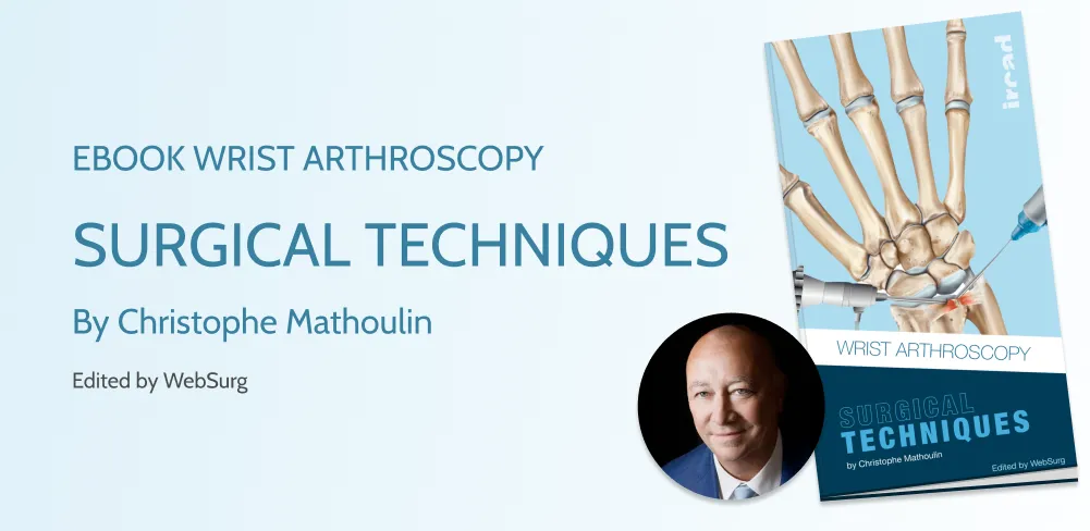 eBook Wrist Arthroscopy by Christophe Mathoulin