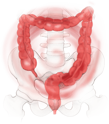 Functional disorders