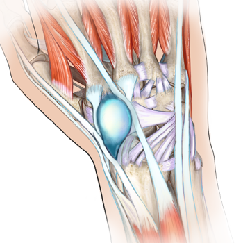 Ligaments / Ganglia