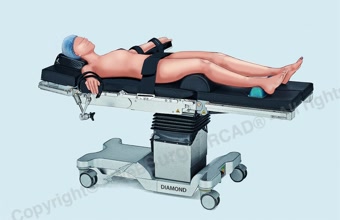 Supine position using leg plates