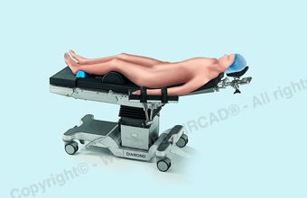 Supine position using the OMFS plate